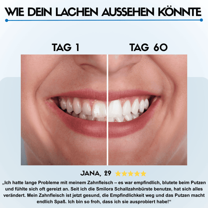 Die Zahnbürste, die deine Zähne in 45 Sekunden automatisch reinigt